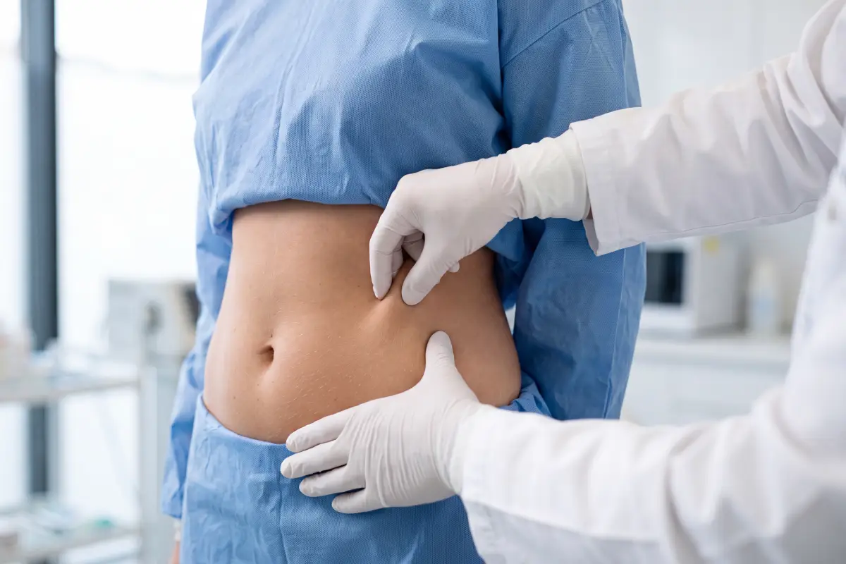 Poliklinika Beograd | Liposukcija